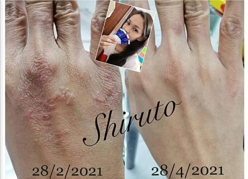 SHIRUTO 见证 皮肤敏感
