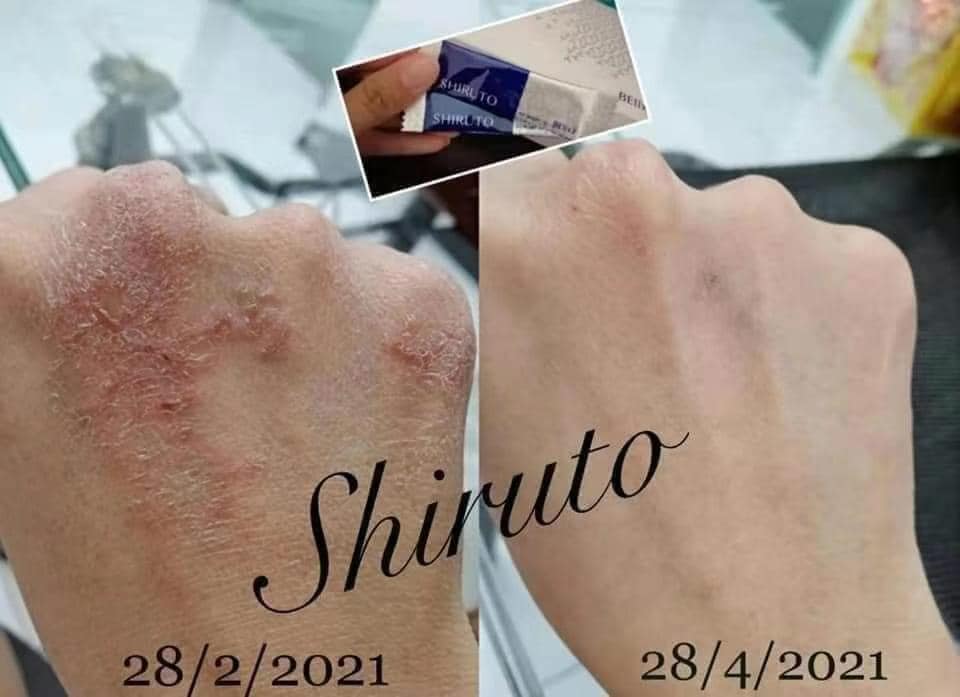 SHIRUTO 见证 皮肤敏感